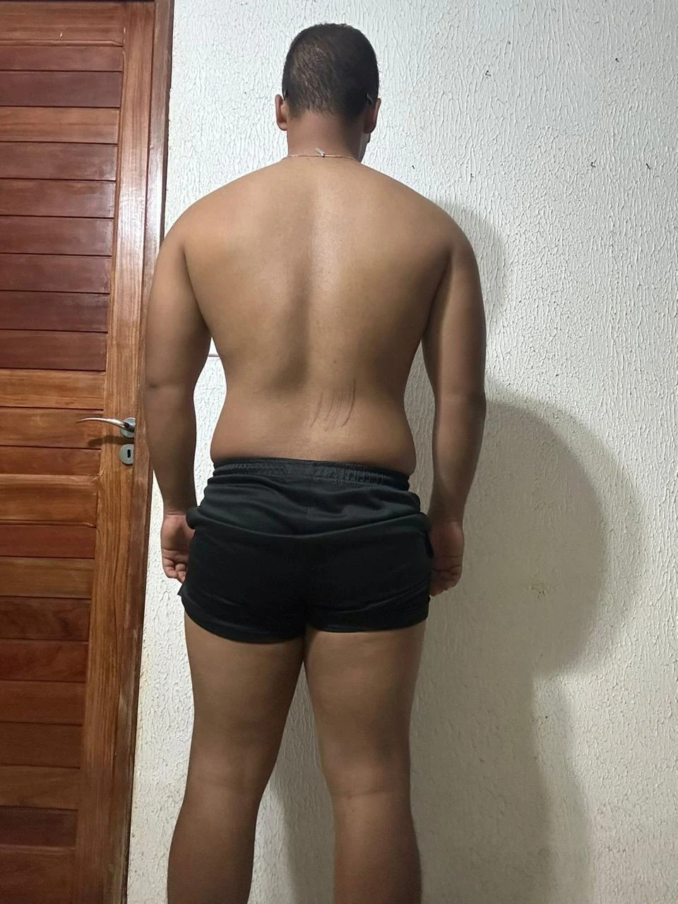 Mentorado 03 antes, de costas